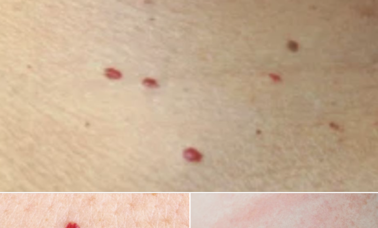 If you spot these red dots on your skin, here’s what they mean