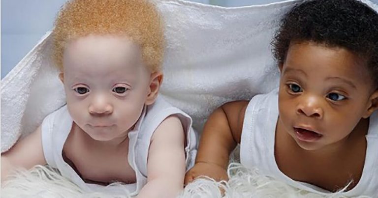Breaking the Mold: Parents Welcome Black and White Twin Boys, Defying Expectations